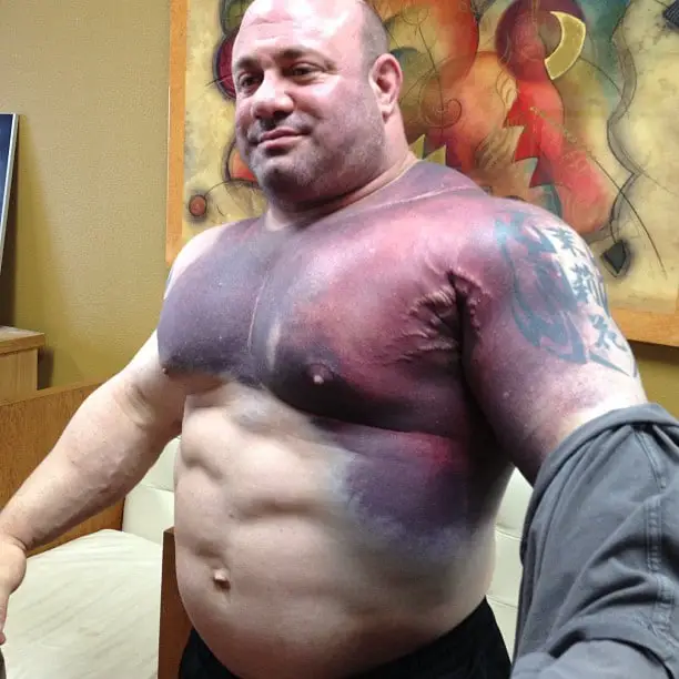 scott mendleson pec tear